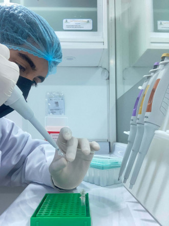 Nested PCR para detección de la enfermedad de la necrosis Hepatopancreática Aguda (EMS/AHPND)
