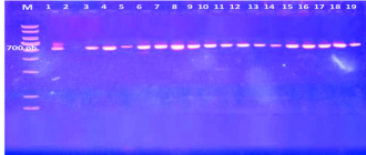 RT-PCR para detección de ISAV