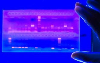 PCR para detección de Anaplasma sp. en sangre