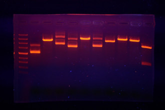 PCR para detección de Babesia sp. en sangre